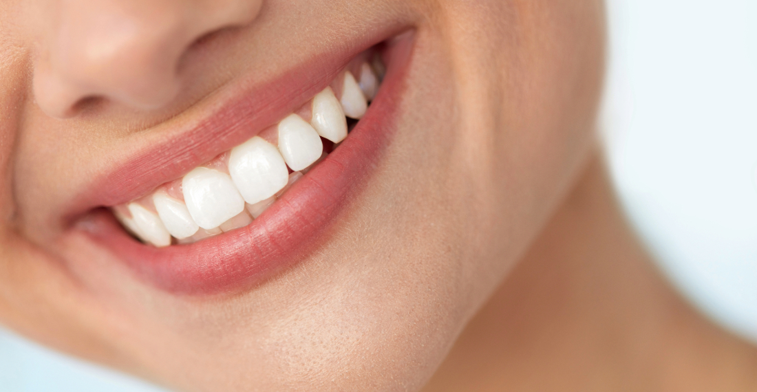 Teeth Whitening Options Miami Lakes